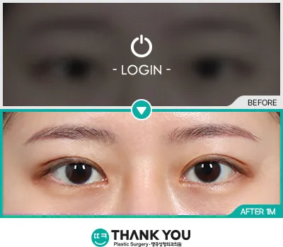 Before/After