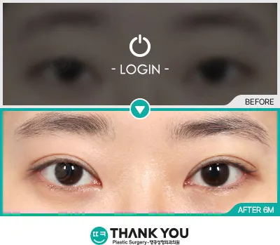 Before/After