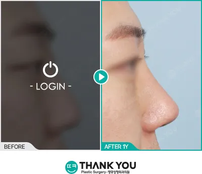 Before/After