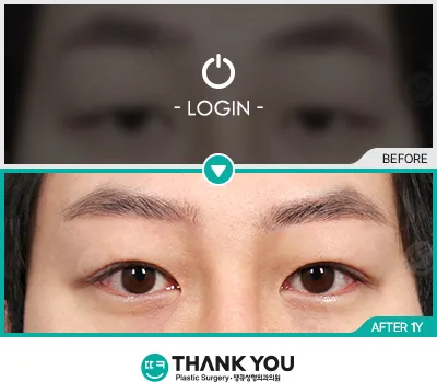 Before/After