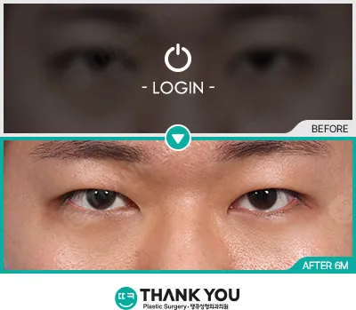 Before/After