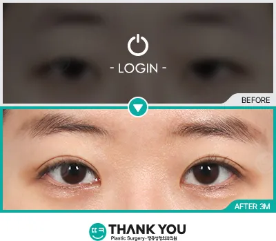 Before/After