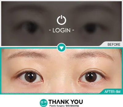 Before/After