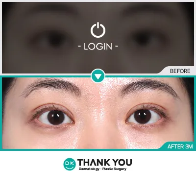 Before/After