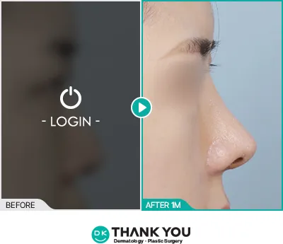 Before/After