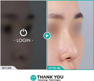 Before/After