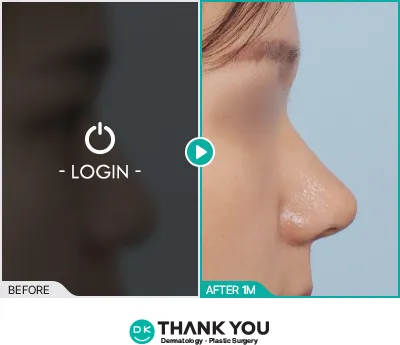 Before/After