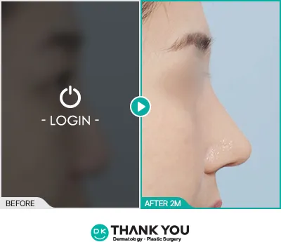 Before/After