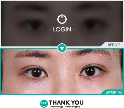 Before/After