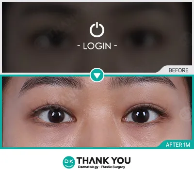 Before/After