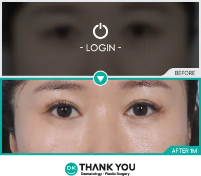 Before/After