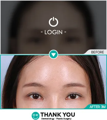 Before/After