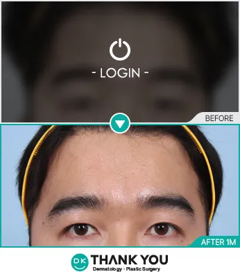 Before/After