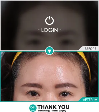Before/After