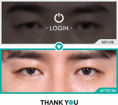 Before/After
