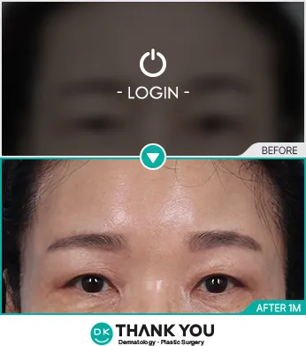 Before/After