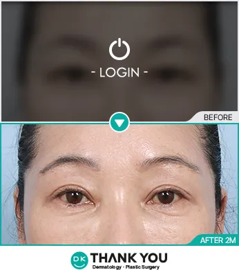 Before/After