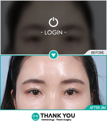 Before/After