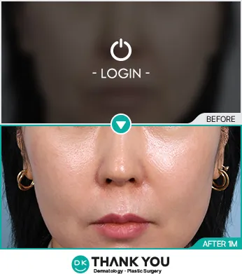Before/After