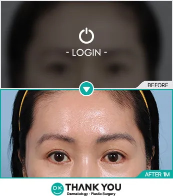 Before/After