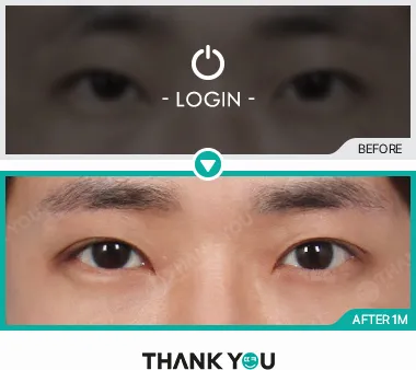 Before/After