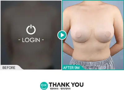 Before/After