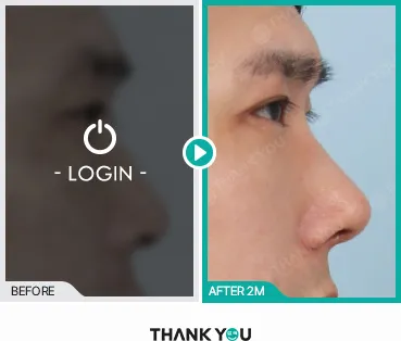 Before/After