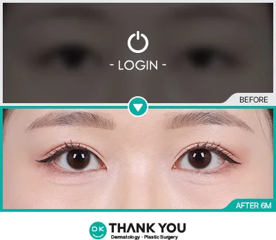 Before/After