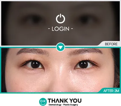 Before/After