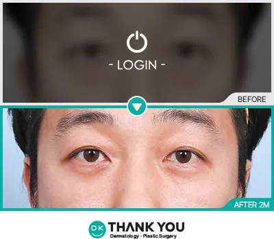 Before/After