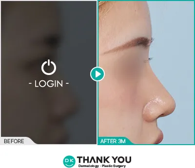 Before/After