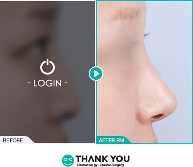 Before/After
