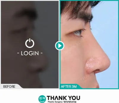 Before/After