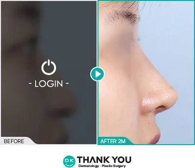 Before/After