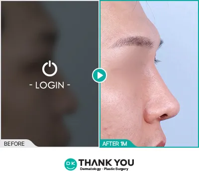 Before/After