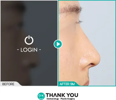 Before/After
