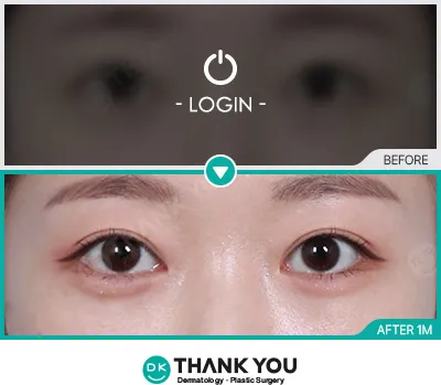 Before/After