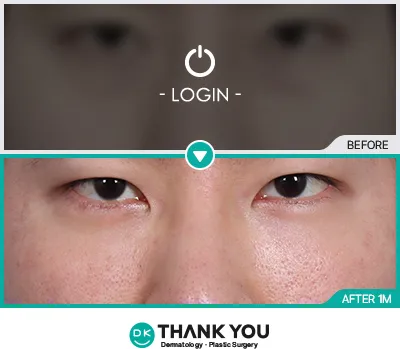 Before/After