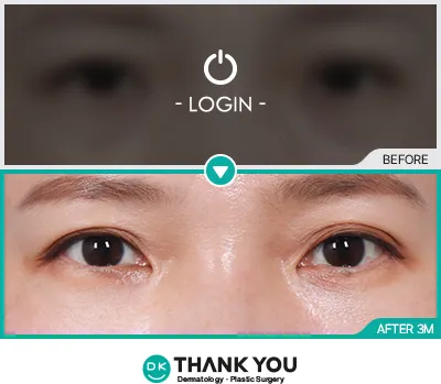 Before/After