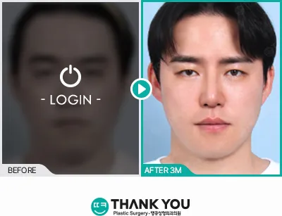 Before/After