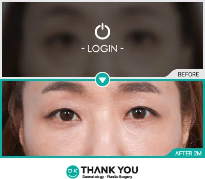 Before/After