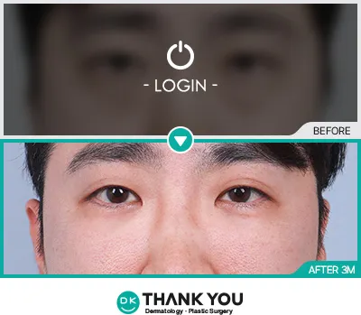 Before/After
