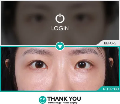 Before & After