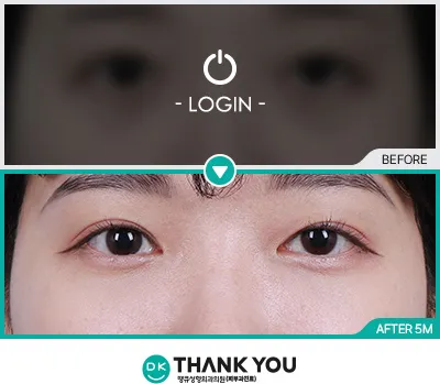 Before/After
