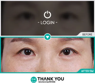 Before/After