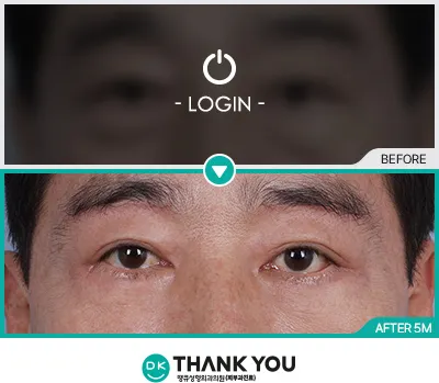 Before/After