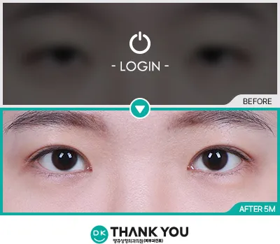 Before/After