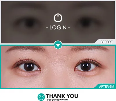 Before/After