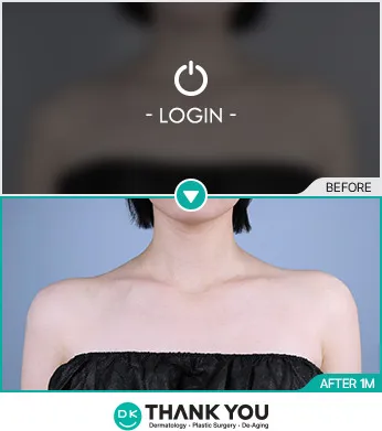 Before/After