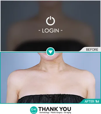 Before/After